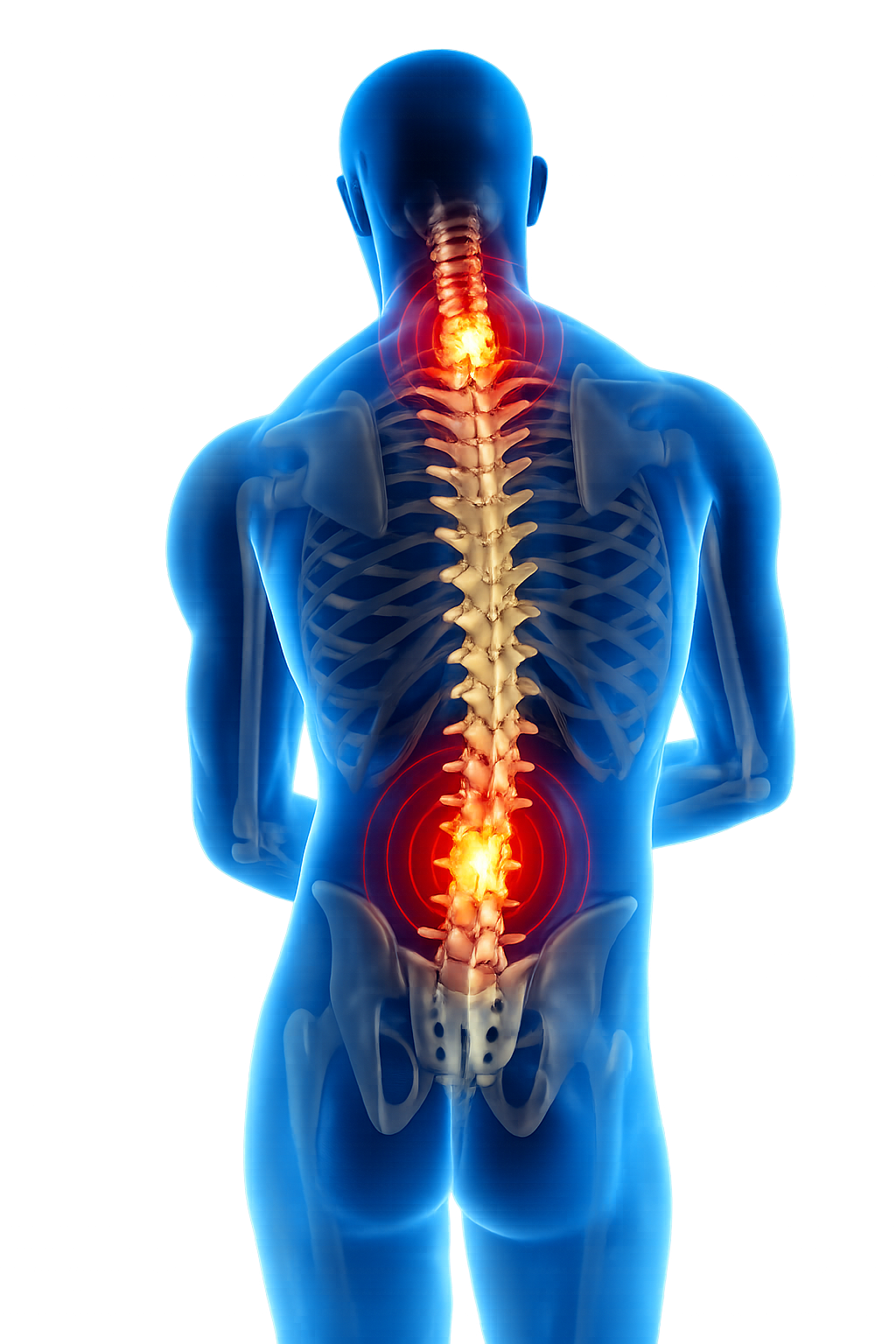 Spine