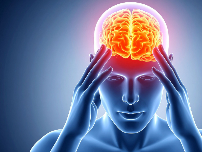 Migraine Treatment